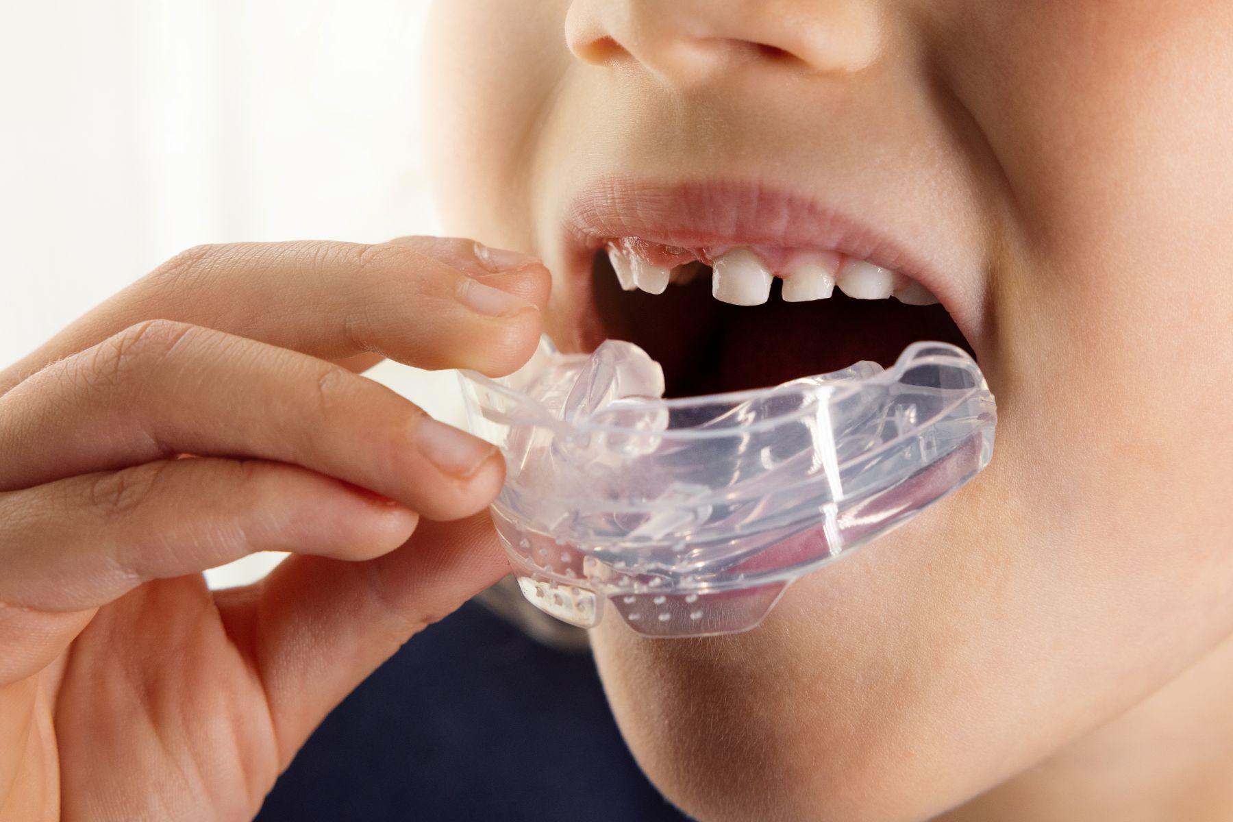 Child using a MyoMunchee growth guide appliance at The Dentist Lounge Santa Monica