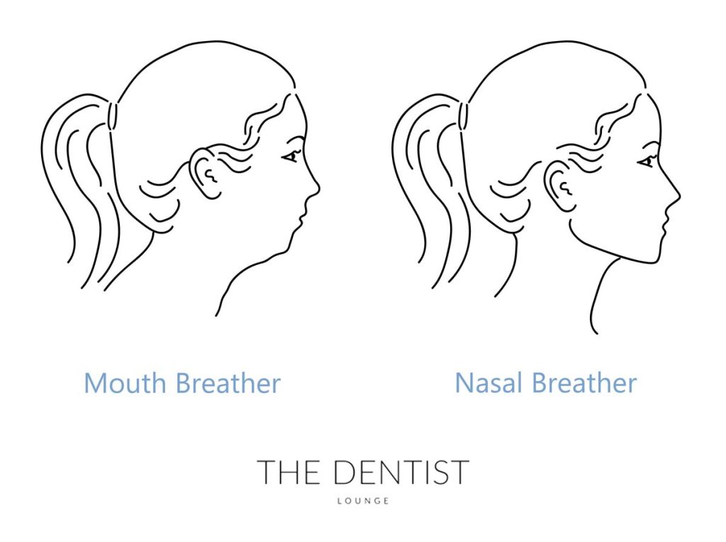 mouth breathing vs nasal breathing