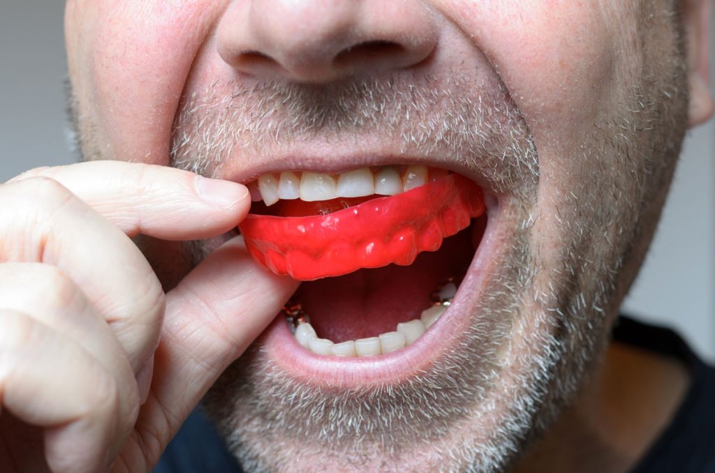 mouth guard for grinding teeth